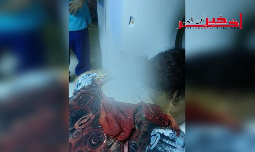 مستشفى القصرين يعجز عن إستخراج سكّين من عنق إمرأة، المدير الجهويّ للصحّة يوضّح