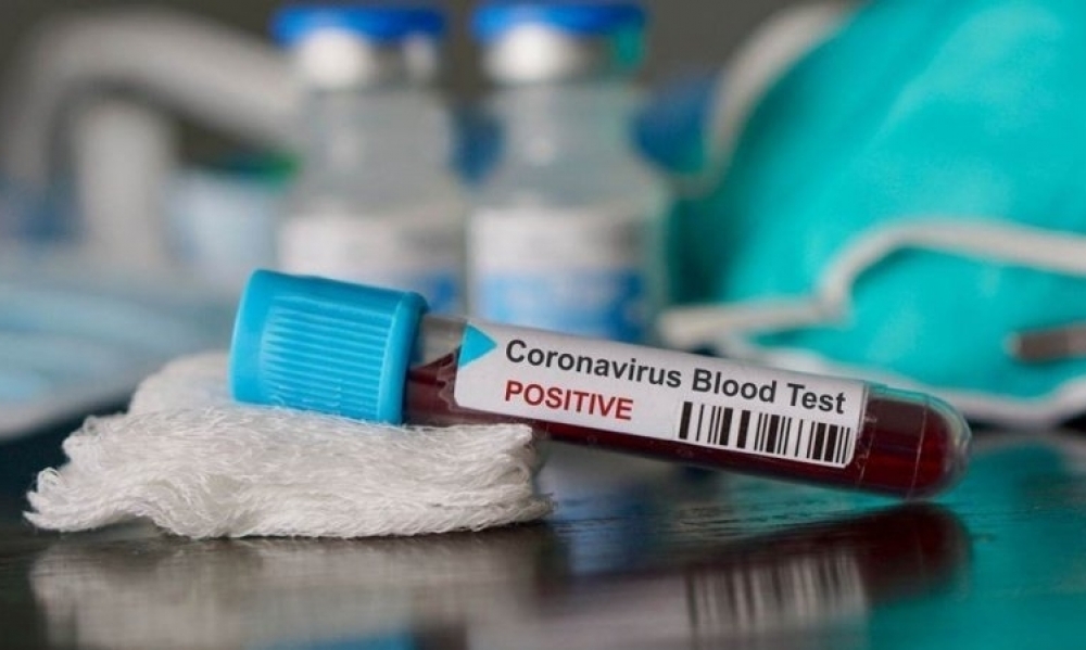 منوبة / تسجيل 4 حالات وفاة و32 إصابة جديدة بفيروس "كورونا"