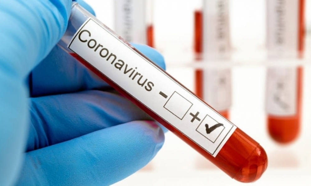 صفاقس / تسجيل 66 إصابة جديدة بفيروس "كورونا" ليرتفع عدد الإصابات بالجهة منذ بداية الوباء إلى 5956 حالة
