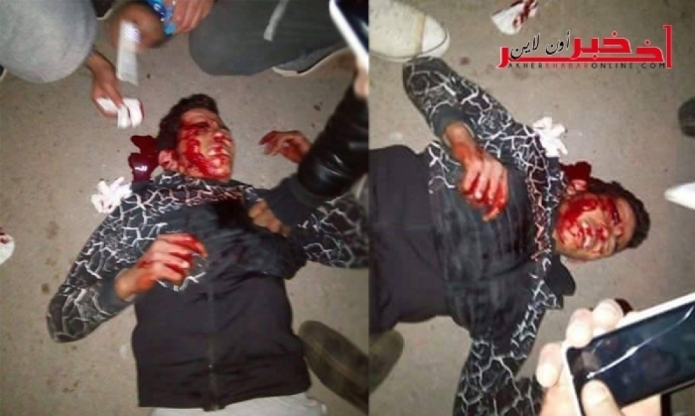 Sidi Bouzid: Un jeune manifestant blessé par un tir de gaz lacrymogène