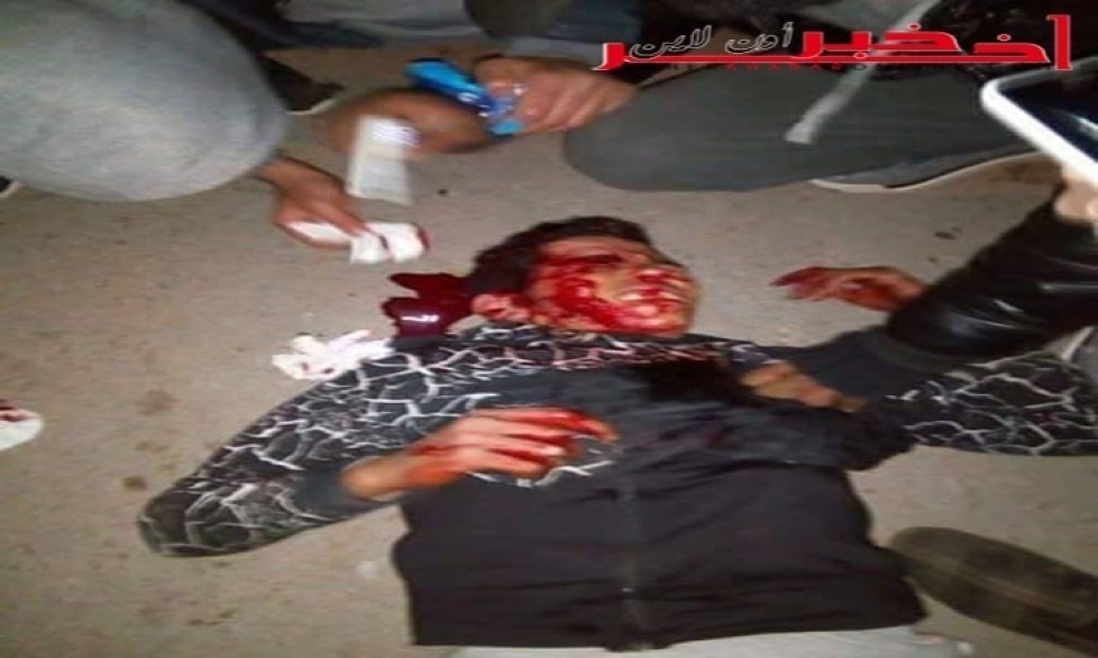 En photo-Sidi Bouzid L’état de santé du jeune blessé par une bombe lacrymogène est stable